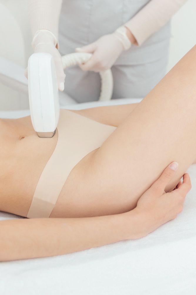 Depilacja laserowa brzucha