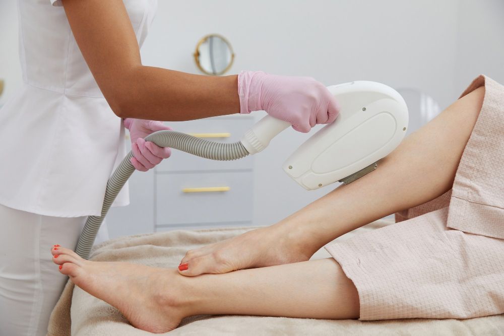 Depilacja laserowa nóg