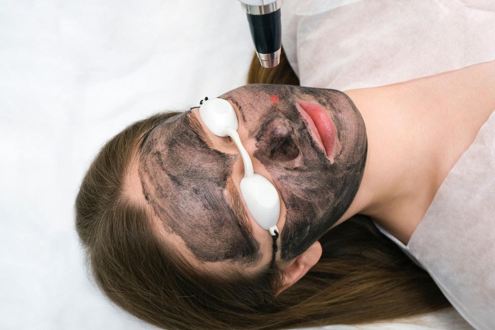 Laserowy peeling węglowy cena