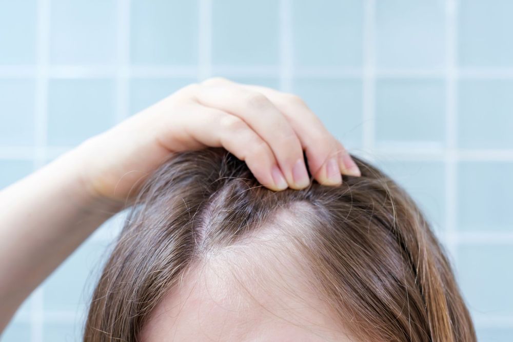 3 najczęstsze błędy w walce z łupieżem